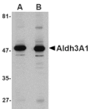 Western blot - Aldh3A1 Antibody from Signalway Antibody (24749) - Antibodies.com