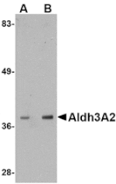 Western blot - Aldh3A2 Antibody from Signalway Antibody (24750) - Antibodies.com