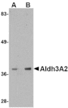 Western blot - Aldh3A2 Antibody from Signalway Antibody (24750) - Antibodies.com