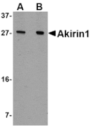 Western blot - Akirin1 Antibody from Signalway Antibody (24755) - Antibodies.com