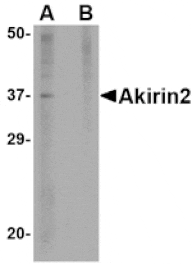 Western blot - Akirin2 Antibody from Signalway Antibody (24757) - Antibodies.com