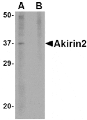 Western blot - Akirin2 Antibody from Signalway Antibody (24757) - Antibodies.com