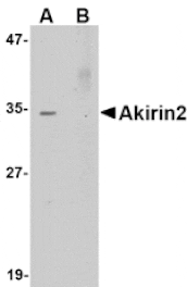 Western blot - Akirin2 Antibody from Signalway Antibody (24758) - Antibodies.com