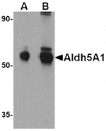 Western blot - Aldh5A1 Antibody from Signalway Antibody (24759) - Antibodies.com