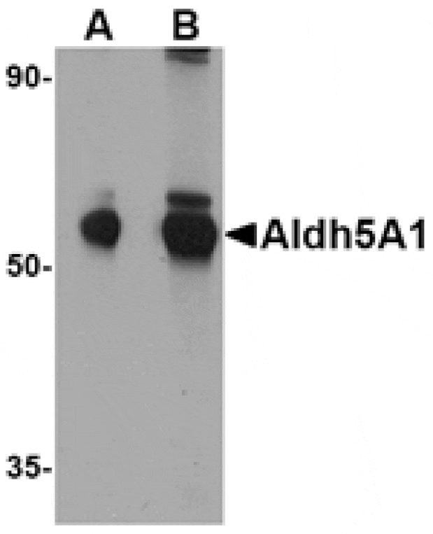 Western blot - Aldh5A1 Antibody from Signalway Antibody (24759) - Antibodies.com