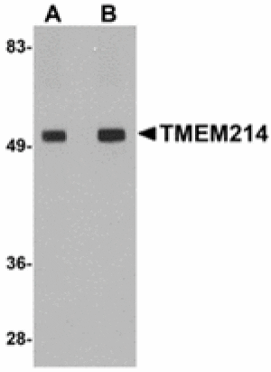 Western blot - TMEM214 Antibody from Signalway Antibody (24947) - Antibodies.com