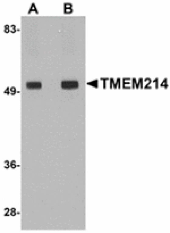 Western blot - TMEM214 Antibody from Signalway Antibody (24947) - Antibodies.com