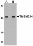 Western blot - TMEM214 Antibody from Signalway Antibody (24947) - Antibodies.com