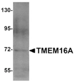 Western blot - TMEM16A Antibody from Signalway Antibody (24979) - Antibodies.com