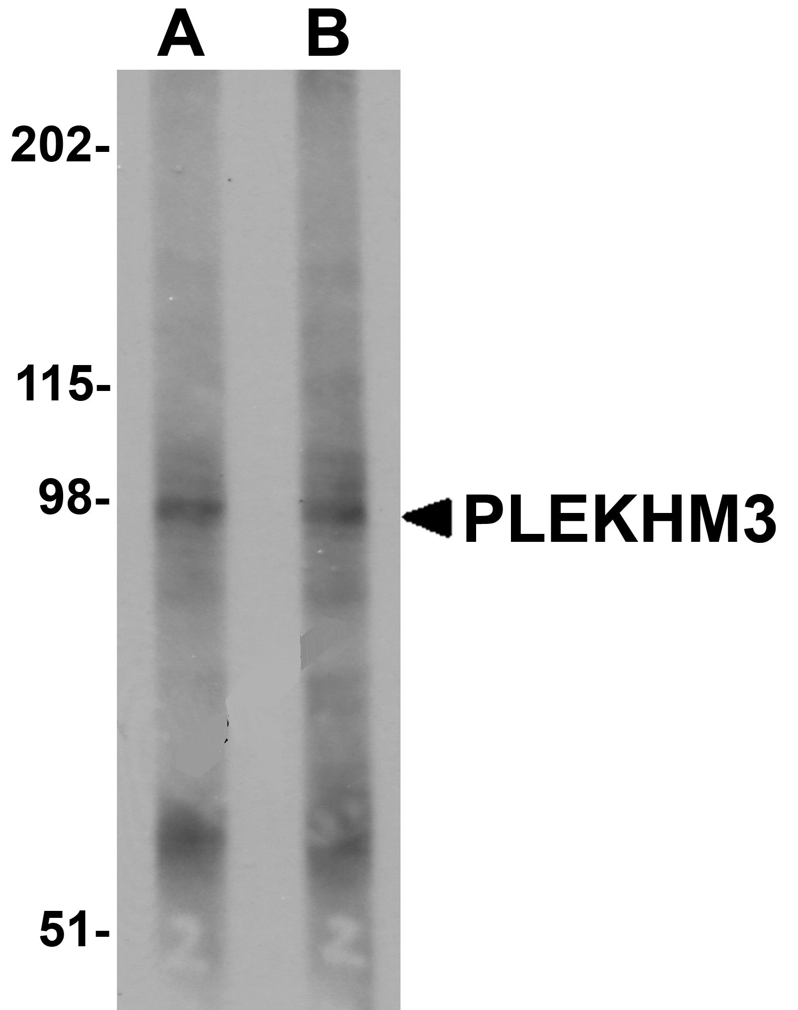 Western blot analysis of PLEKHM3 in mouse skeletal muscle tissue lysate with PLEKHM3 antibody at (A) 1 and (B) 2 µg/mL.