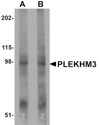 Western blot - PLEKHM3 Antibody from Signalway Antibody (25005) - Antibodies.com