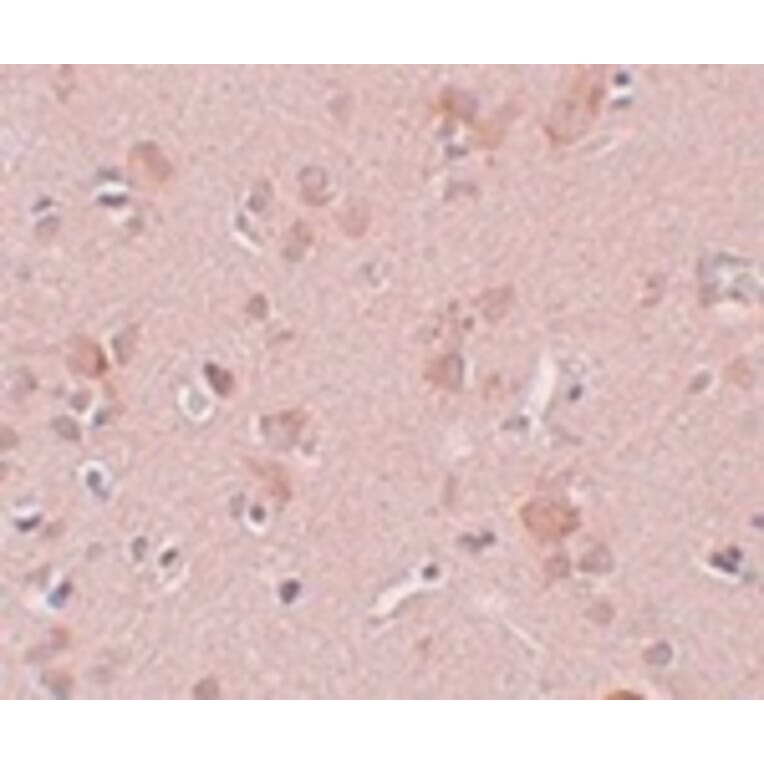 Immunohistochemistry - PLEKHM3 Antibody from Signalway Antibody (25005) - Antibodies.com