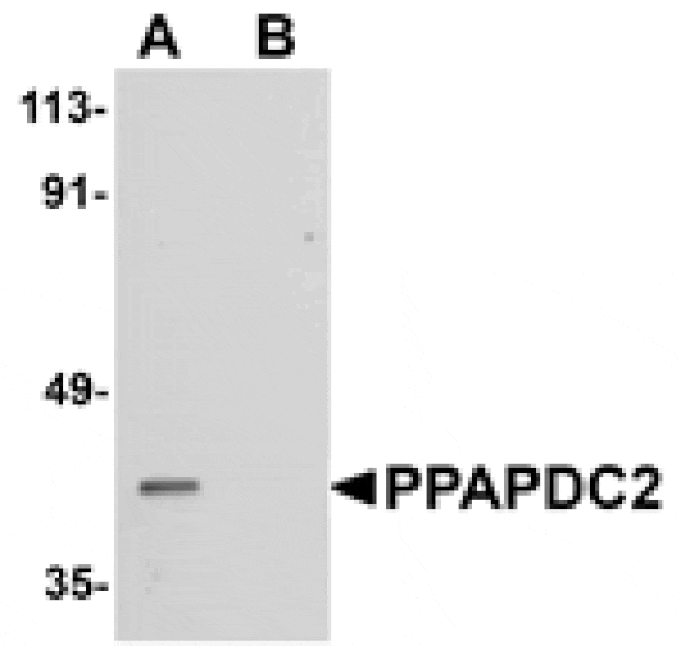 Western blot - PPAPDC2 Antibody from Signalway Antibody (25016) - Antibodies.com