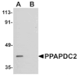 Western blot - PPAPDC2 Antibody from Signalway Antibody (25016) - Antibodies.com