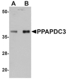 Western blot - PPAPDC3 Antibody from Signalway Antibody (25017) - Antibodies.com