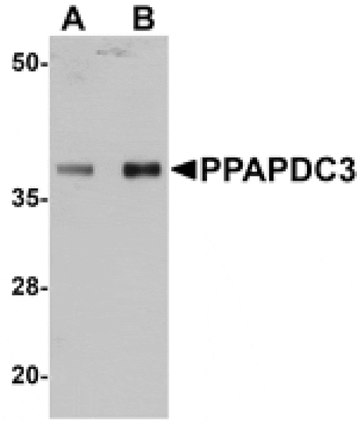 Western blot - PPAPDC3 Antibody from Signalway Antibody (25017) - Antibodies.com
