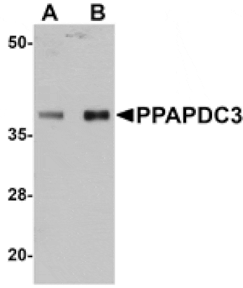 Western blot - PPAPDC3 Antibody from Signalway Antibody (25017) - Antibodies.com