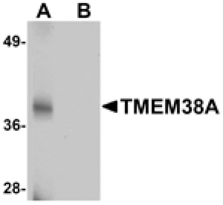Western blot - TMEM38A Antibody from Signalway Antibody (25018) - Antibodies.com