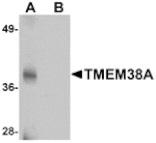 Western blot - TMEM38A Antibody from Signalway Antibody (25018) - Antibodies.com