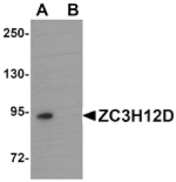 Western blot - ZC3H12D Antibody from Signalway Antibody (25088) - Antibodies.com