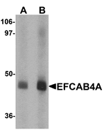 Western blot analysis of EFCAB4A in human lung tissue lysate with EFCAB4A antibody at (A) 1 and (B) 2 µg/mL.
