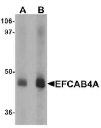 Western blot - EFCAB4A Antibody from Signalway Antibody (25214) - Antibodies.com