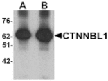 Western blot - CTTNBL1 Antibody from Signalway Antibody (25271) - Antibodies.com