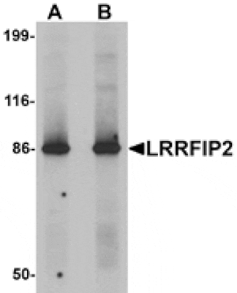 Western blot - LRRFIP2 Antibody from Signalway Antibody (25274) - Antibodies.com