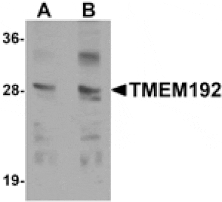 Western blot - TMEM192 Antibody from Signalway Antibody (25277) - Antibodies.com