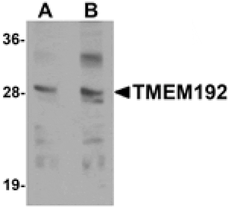 Western blot - TMEM192 Antibody from Signalway Antibody (25277) - Antibodies.com