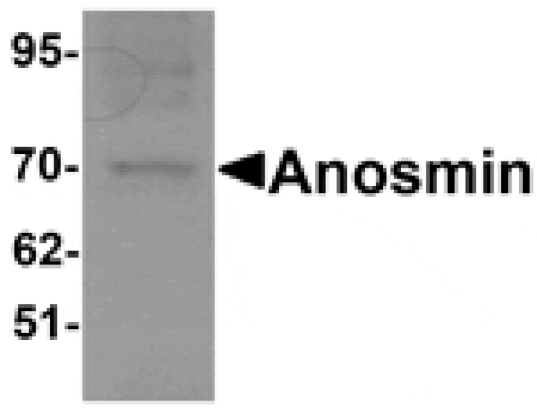 Western blot - Anosmin Antibody from Signalway Antibody (25311) - Antibodies.com