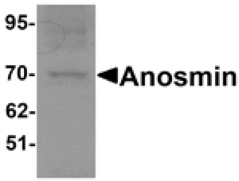 Western blot - Anosmin Antibody from Signalway Antibody (25311) - Antibodies.com