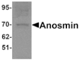 Western blot - Anosmin Antibody from Signalway Antibody (25311) - Antibodies.com