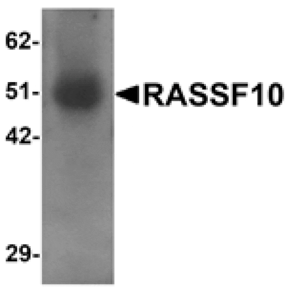 Western blot - RASSF10 Antibody from Signalway Antibody (25313) - Antibodies.com