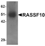 Western blot - RASSF10 Antibody from Signalway Antibody (25313) - Antibodies.com