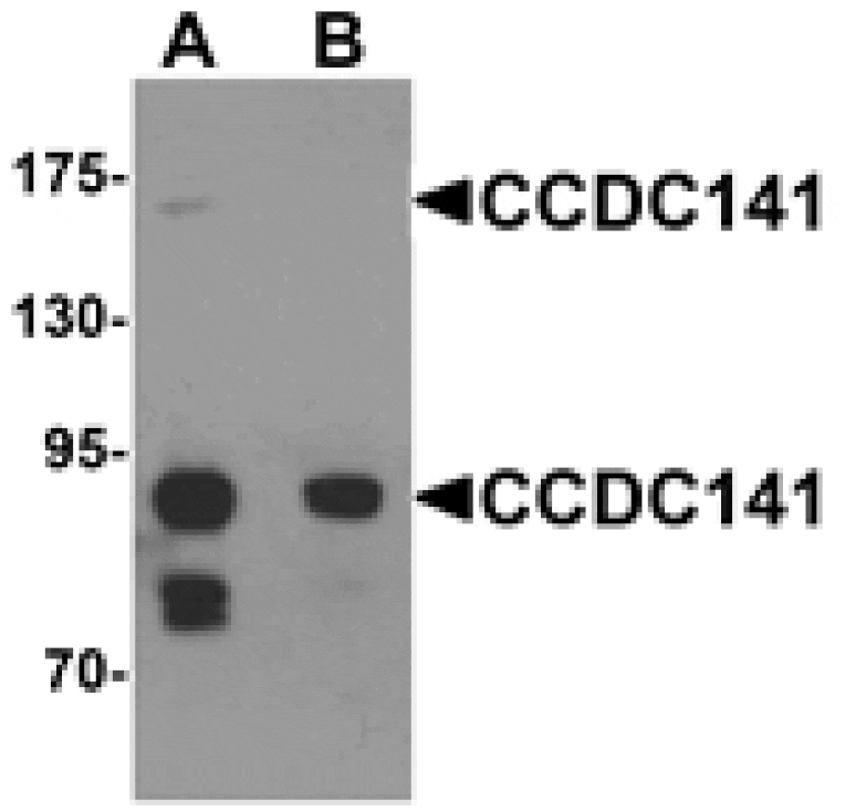 Western blot - CCDC141 Antibody from Signalway Antibody (25327) - Antibodies.com