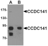 Western blot - CCDC141 Antibody from Signalway Antibody (25327) - Antibodies.com