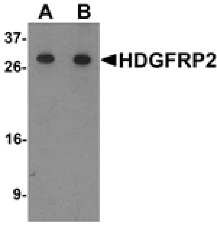 Western blot - HDGFRP2 Antibody from Signalway Antibody (25332) - Antibodies.com