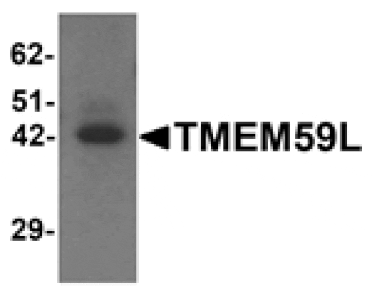 Western blot - TMEM59L Antibody from Signalway Antibody (25337) - Antibodies.com