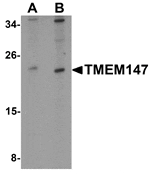 Western blot analysis of TMEM147 in Daudi cell lysate with TMEM147 antibody at (A) 1 and (B) 2 µg/mL.