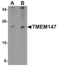 Western blot - TMEM147 Antibody from Signalway Antibody (25346) - Antibodies.com