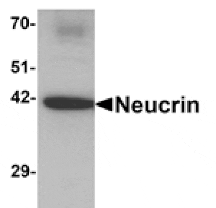 Western blot - NEUCRIN Antibody from Signalway Antibody (25359) - Antibodies.com