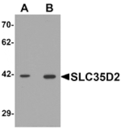 Western blot - SLC35D2 Antibody from Signalway Antibody (25374) - Antibodies.com