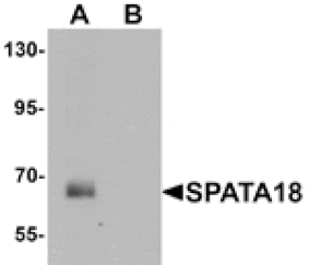 Western blot - SPATA18 Antibody from Signalway Antibody (25395) - Antibodies.com