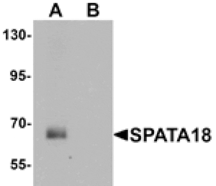 Western blot - SPATA18 Antibody from Signalway Antibody (25395) - Antibodies.com