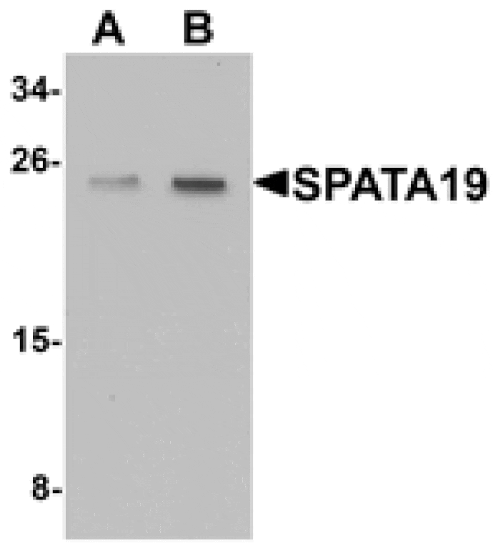 Western blot - SPATA19 Antibody from Signalway Antibody (25396) - Antibodies.com