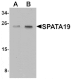 Western blot - SPATA19 Antibody from Signalway Antibody (25396) - Antibodies.com