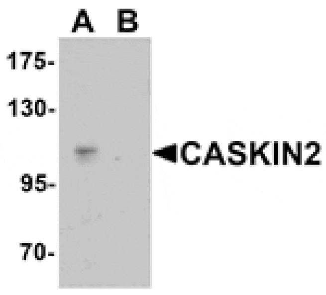 Western blot - CASKIN2 Antibody from Signalway Antibody (25414) - Antibodies.com