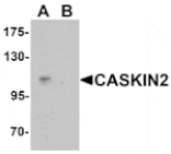 Western blot - CASKIN2 Antibody from Signalway Antibody (25414) - Antibodies.com