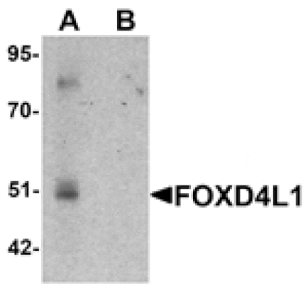 Western blot - FOXD4L1 Antibody from Signalway Antibody (25420) - Antibodies.com